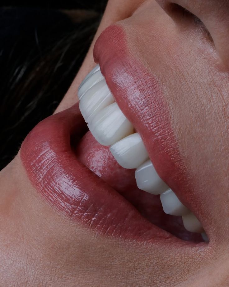 İşman Dental galeri görseli